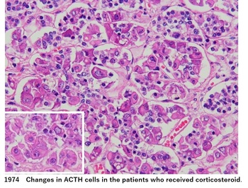 ACTH cell.jpg